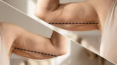 Slappa armar? 3 enkla övningar från en personlig tränare